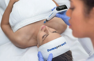 Traitement de microneedling de 460$ - St-Laurent Médico-Esthétique